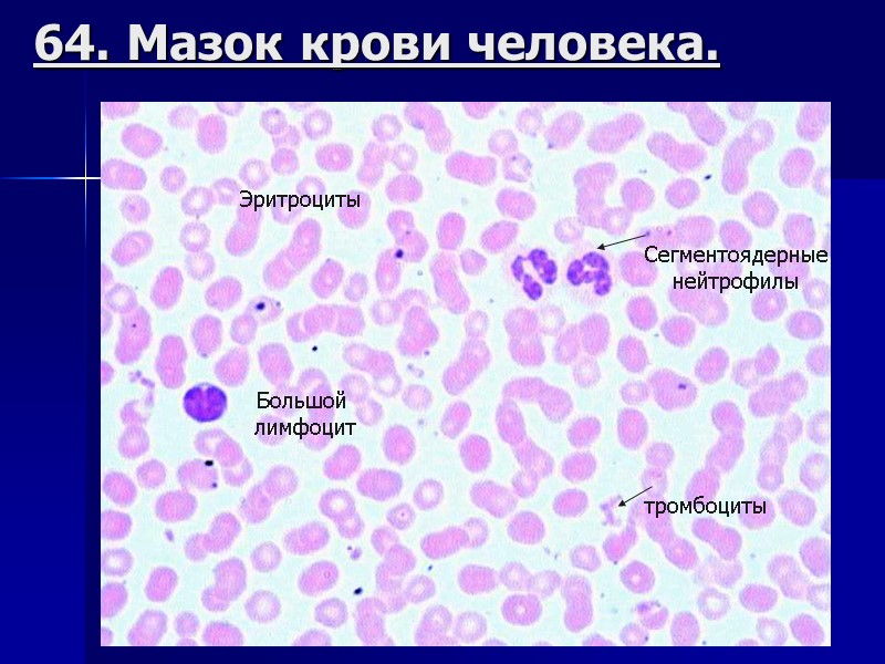 64. Мазок крови человека. Сегментоядерные нейтрофилы Большой  лимфоцит тромбоциты Эритроциты